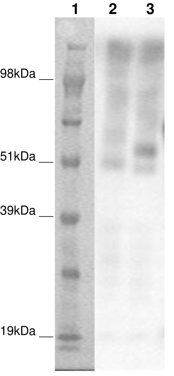 PathHunter® Human GPR61 β-Arrestin Cell-Based Assay Kit (CHO-K1)