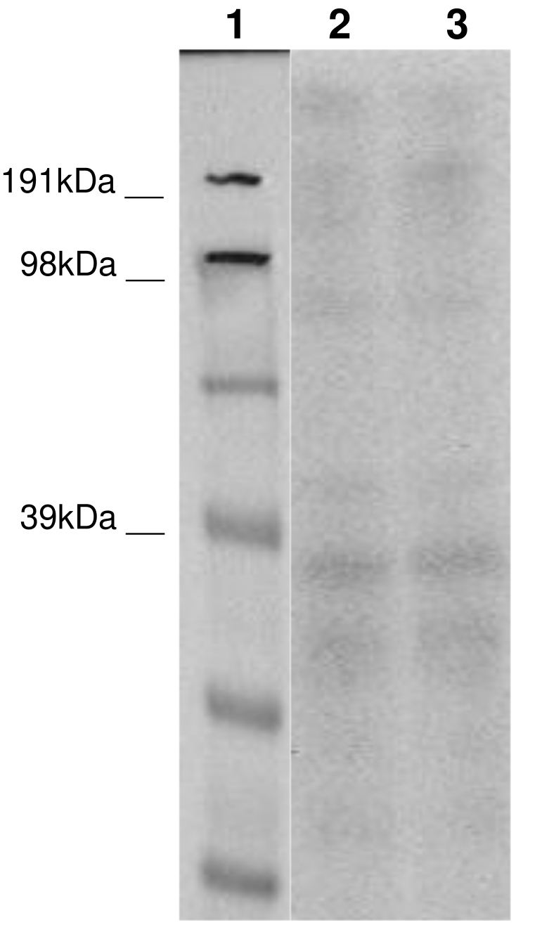 PathHunter® Human ADGRB2 (BAI2) β-Arrestin Cell-Based Assay Kit (CHO-K1)
