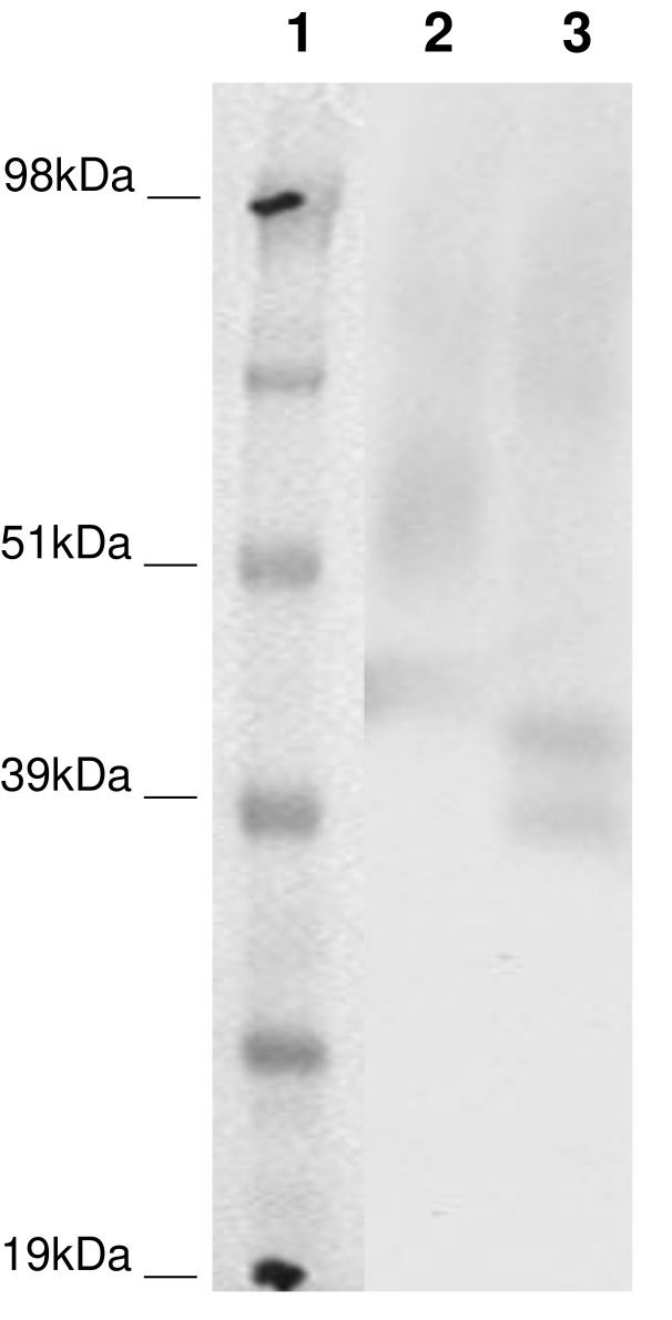 PathHunter® Human P2RY8 β-Arrestin Cell-Based Assay Kit (CHO-K1)