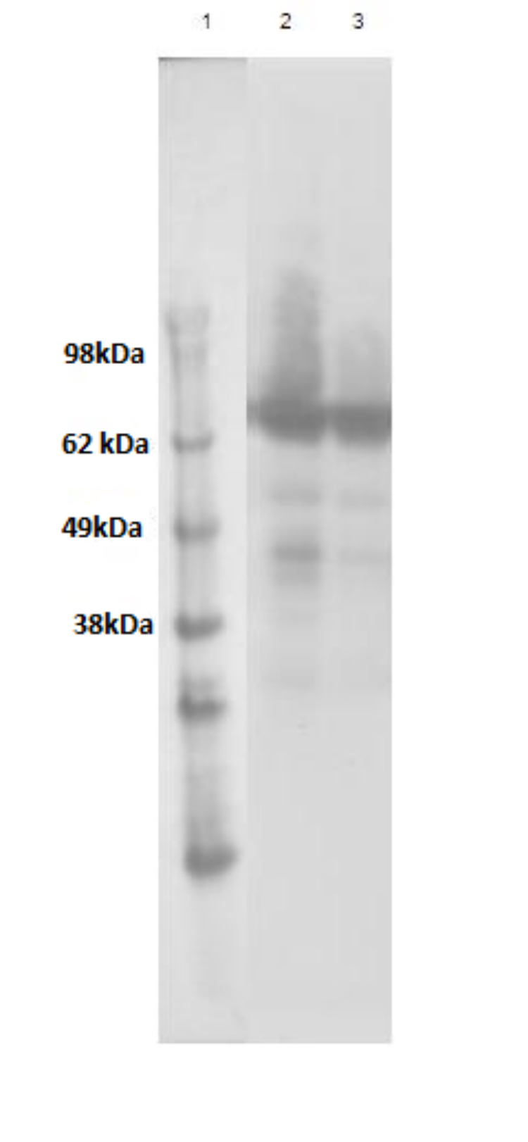PathHunter® Human GPR50 β-Arrestin Cell-Based Assay Kit (CHO-K1)
