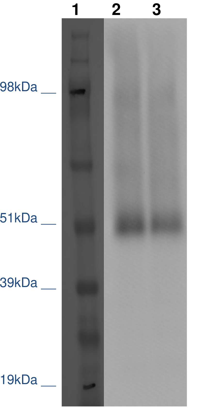 PathHunter® Human GPR101 β-Arrestin Cell-Based Assay Kit (CHO-K1)