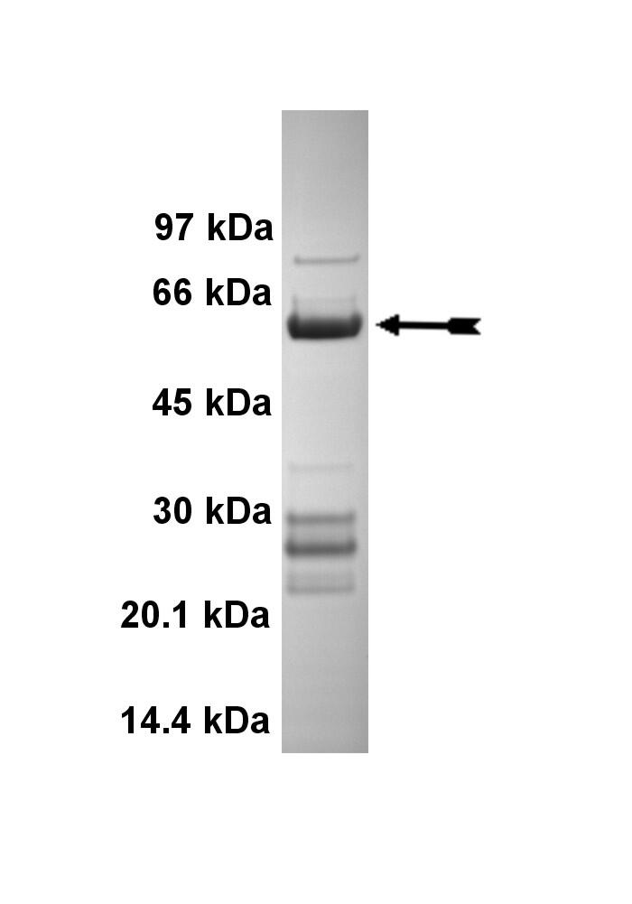 Casein Kinase 1delta (aa 1-294), active