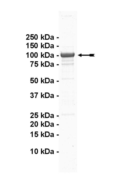 DYRK1B, active