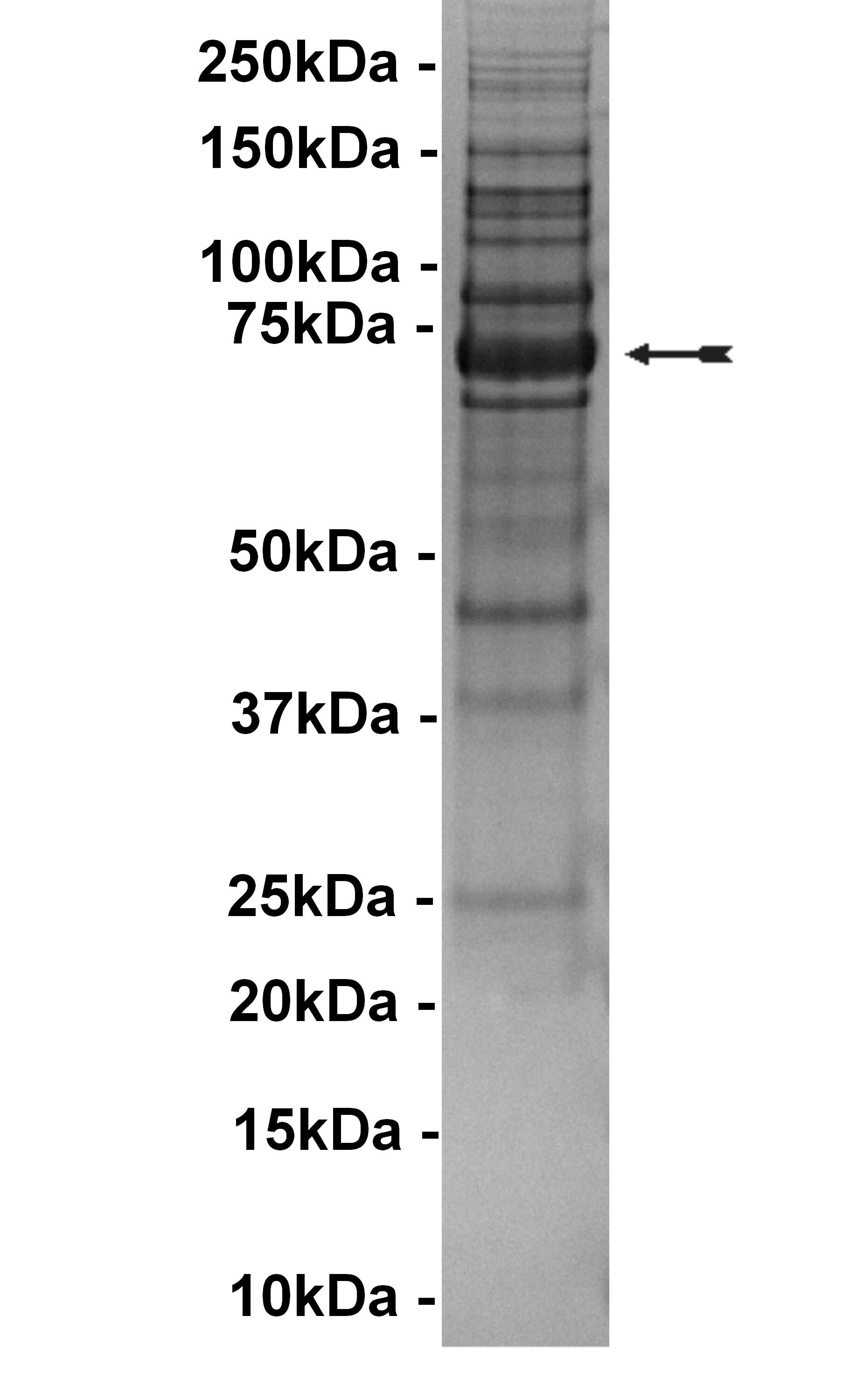 BTK (E41K), active