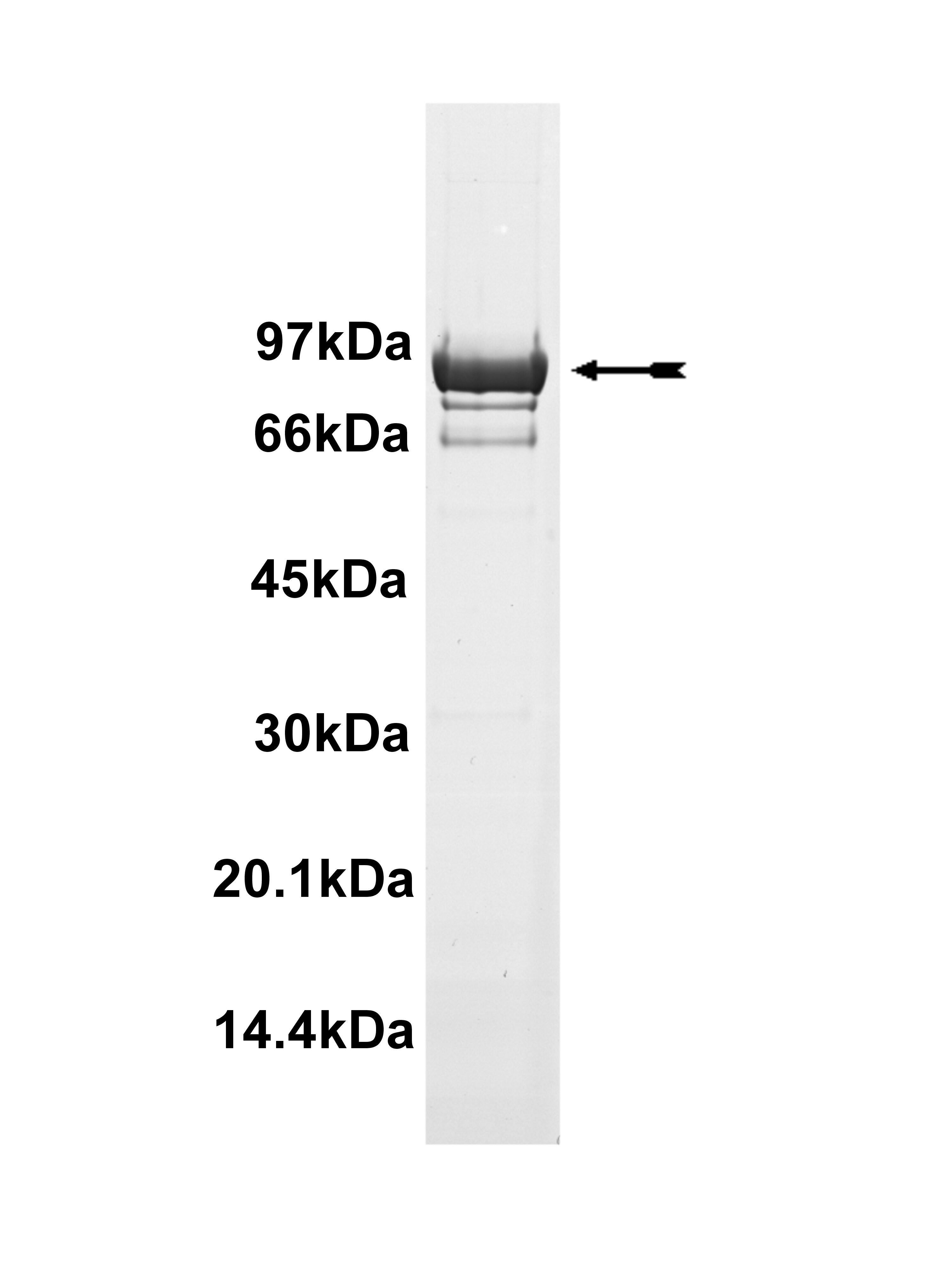 EGFR (T790M), active