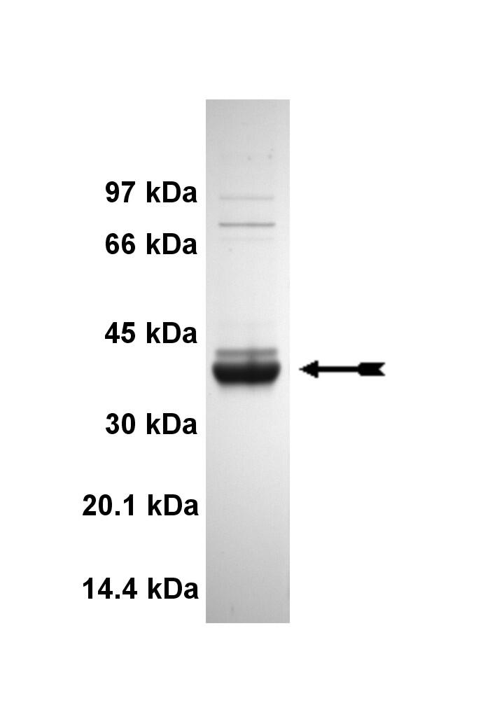 CaM Kinase IIdelta, active