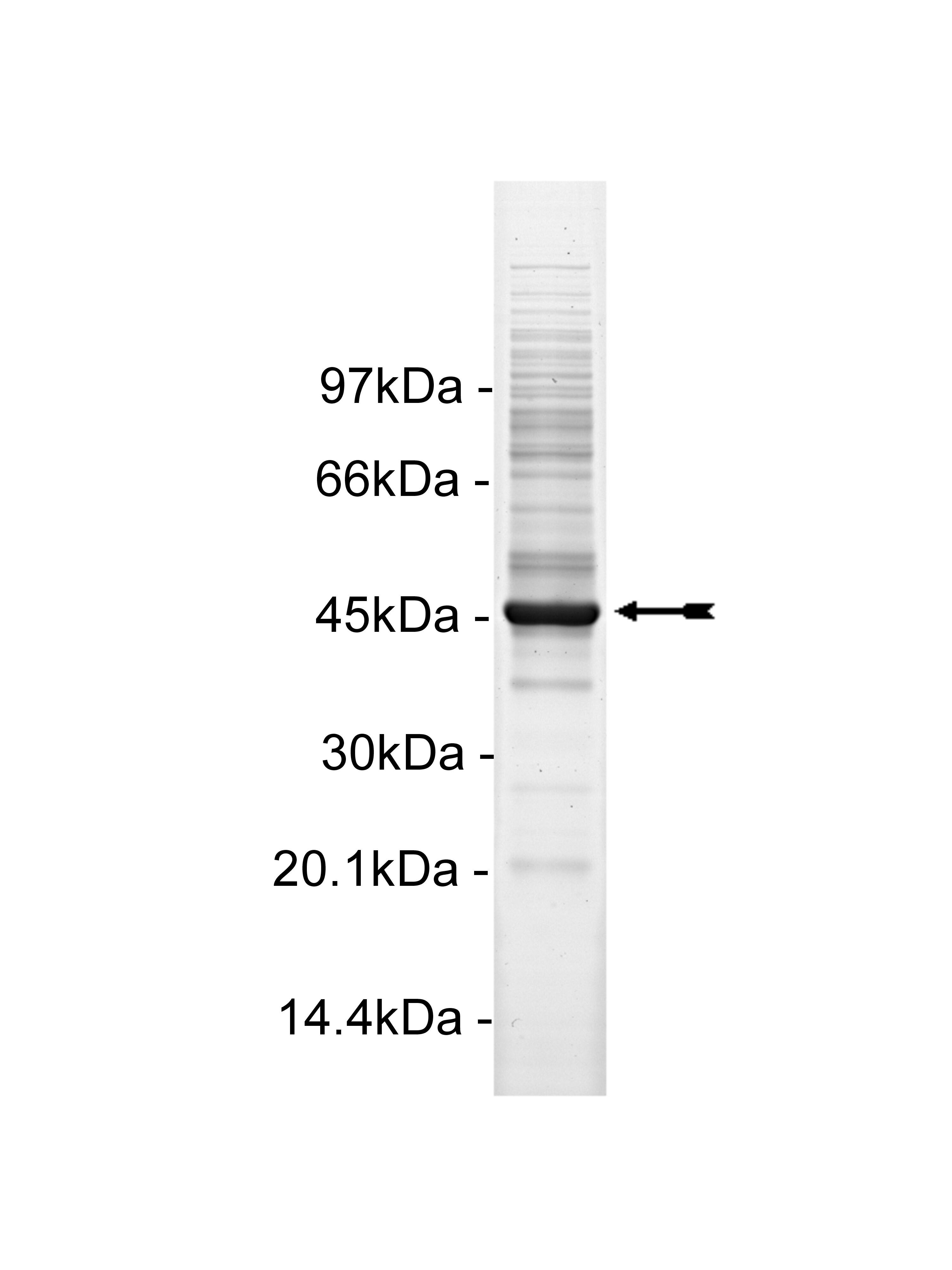 TSSK2, active