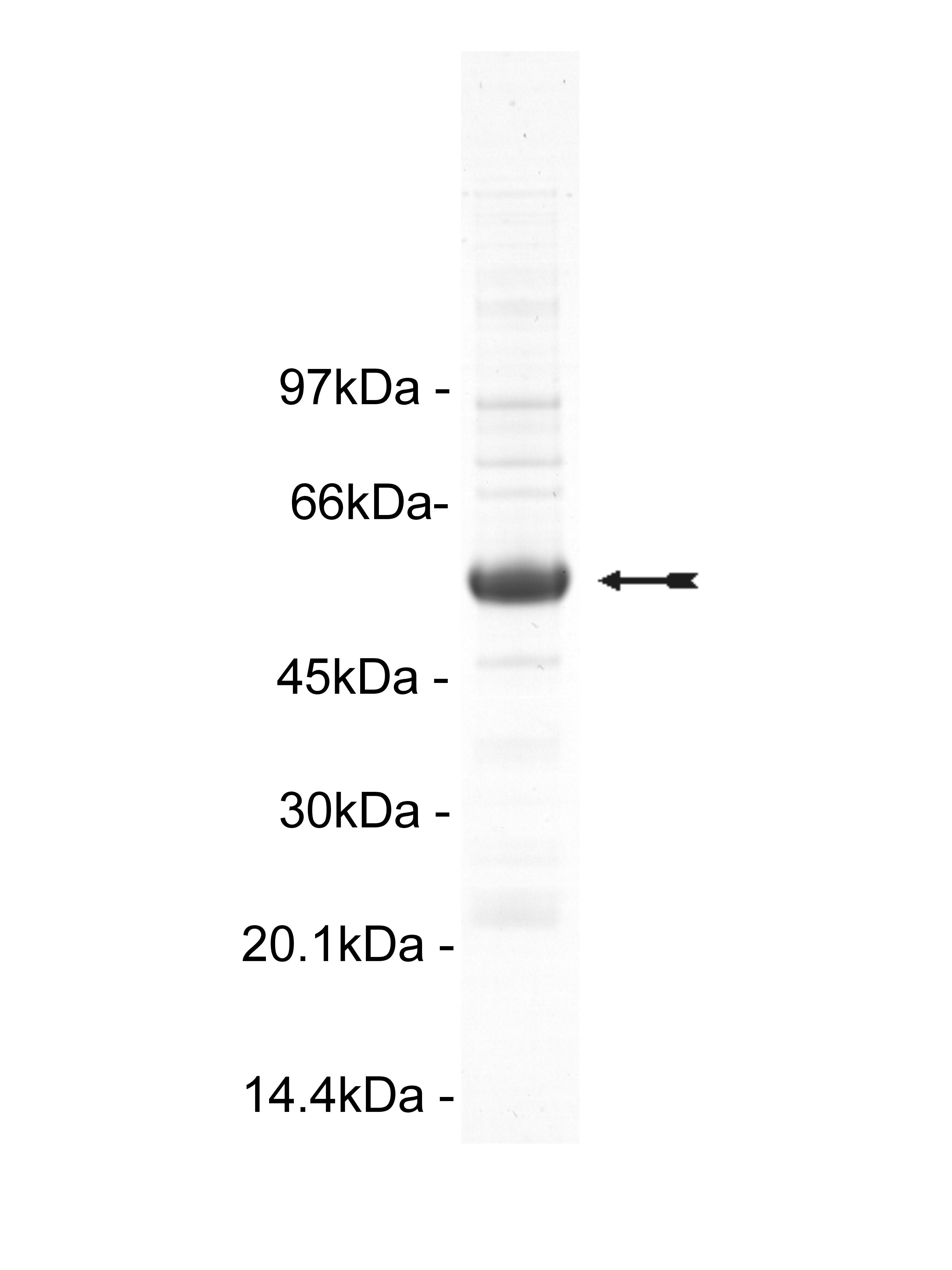 CaM Kinase IV, active